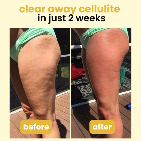 Anti-Cellulite Massage Oil Collagen + Stem Cell Infused