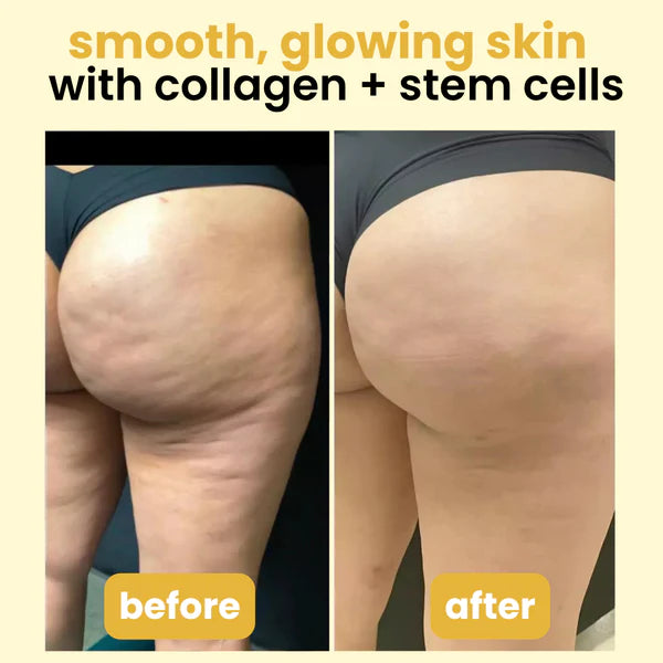Anti-Cellulite Massage Oil Collagen + Stem Cell Infused