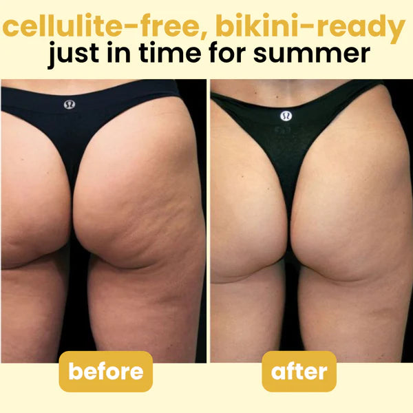 Anti-Cellulite Massage Oil Collagen + Stem Cell Infused