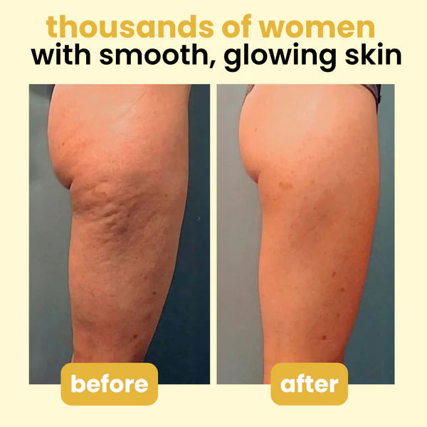 Anti-Cellulite Massage Oil Collagen + Stem Cell Infused